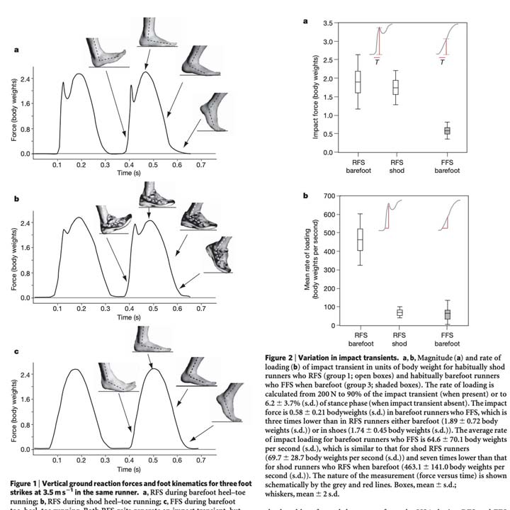 Study Barefoot shoes transition results from switching to minimalist footwear on 65 people